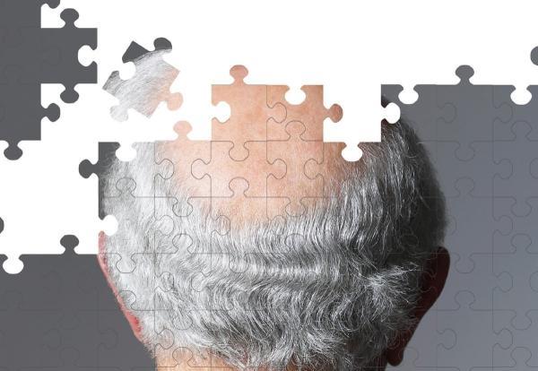 کشف یک عامل کلیدی نو در ابتلا به آلزایمر